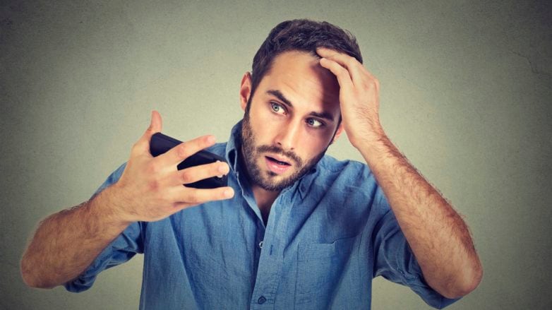 Causes of Hair Loss in Men  The Top Culprits - 85